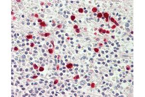Anti-MYO1E / Myosin IE antibody IHC staining of human spleen.