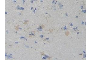 Detection of WARS in Human Cerebrum Tissue using Polyclonal Antibody to Tryptophanyl tRNA Synthetase (WARS)