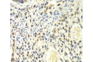Immunohistochemistry of paraffin-embedded Human colon using PSMA4 Polyclonal Antibody at dilution of 1:100 (40x lens). (PSMA4 anticorps)