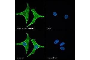 ABIN185280 Immunofluorescence analysis of paraformaldehyde fixed HeLa cells, permeabilized with 0.
