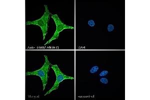 ABIN185280 Immunofluorescence analysis of paraformaldehyde fixed HeLa cells, permeabilized with 0. (ANTXR1 anticorps  (C-Term))