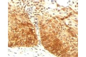 IHC testing of FFPE human prostate with Cytokeratin 14 antibody (KRT14 anticorps  (C-Term))