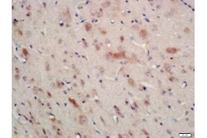 Formalin-fixed and paraffin embedded rat brain labeled with Anti-AMPK alpha-1 Polyclonal Antibody, Unconjugated (ABIN2170161) at 1:200 followed by conjugation to the secondary antibody and DAB staining