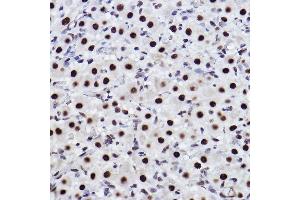 Immunohistochemistry of paraffin-embedded rat ovary using CTBP2 Rabbit mAb (ABIN7265979) at dilution of 1:100 (40x lens). (CTBP2 anticorps)