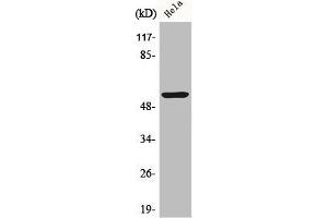 Western Blot analysis of HeLa cells using Cytokeratin 10 Polyclonal Antibody
