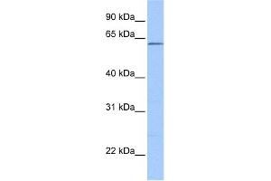 WB Suggested Anti-ZKSCAN4 Antibody Titration:  0. (ZKSCAN4 anticorps  (N-Term))