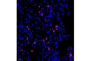Immunofluorescence of paraffin embedded rat lung using UBE3A (ABIN7076105) at dilution of 1:650 (400x lens)