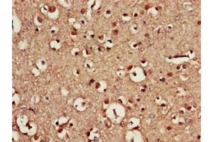 Immunohistochemistry of paraffin-embedded human brain tissue using ABIN7155665 at dilution of 1:100 (CDX4 anticorps  (AA 16-174))