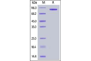 Human LRRC32, Fc Tag on  under reducing (R) condition. (LRRC32 Protein (AA 20-627) (Fc Tag))