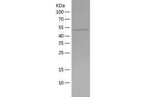 Western Blotting (WB) image for Suppressor of Cytokine Signaling 3 (SOCS3) (AA 1-225) protein (His-IF2DI Tag) (ABIN7125255)