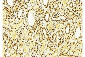 ABIN6275007 at 1/100 staining Mouse kidney tissue by IHC-P.