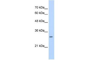WB Suggested Anti-SLBP Antibody Titration:  0. (SLBP anticorps  (Middle Region))