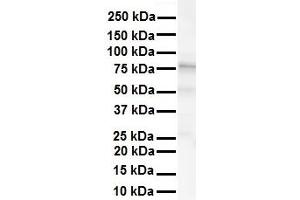 WB Suggested Anti-KCNC3 antibody Titration: 1 ug/mL Sample Type: Human liver (KCNC3 anticorps  (Middle Region))