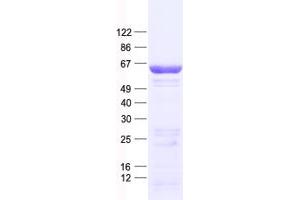 Validation with Western Blot (CDC6 Protein (His tag))