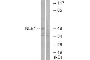 Western blot analysis of extracts from COS cells, using NLE1 antibody. (NLE1 anticorps  (Internal Region))