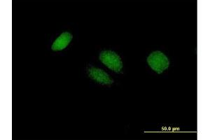 Immunofluorescence of purified MaxPab antibody to BTG4 on HeLa cell. (BTG4 anticorps  (AA 1-206))