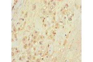 Immunohistochemistry of paraffin-embedded human placenta tissue using ABIN7171488 at dilution of 1:100