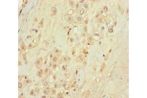 Immunohistochemistry of paraffin-embedded human placenta tissue using ABIN7171488 at dilution of 1:100 (TLN2 anticorps  (AA 88-406))