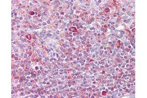 Anti-RELB antibody IHC of human spleen.