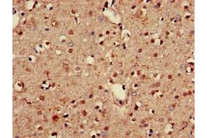 Immunohistochemistry of paraffin-embedded human brain tissue using ABIN7153517 at dilution of 1:100 (GABARAPL1 anticorps  (AA 1-117))
