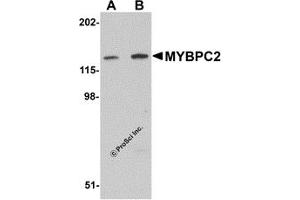 Western Blotting (WB) image for anti-Myosin Binding Protein C, Fast Type (MYBPC2) (C-Term) antibody (ABIN1030525)