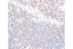Immunohistochemistry of paraffin-embedded Human appendix using KIF14 Polyclonal Antibody at dilution of 1:100 (40x lens).