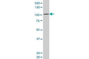 LRP8 polyclonal antibody (A01), Lot # 051007JC01 Western Blot analysis of LRP8 expression in SJCRH30