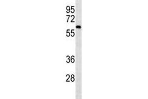 CAMKK2 western blot analysis in mouse cerebellum tissue lysate.