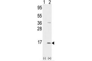 Western blot analysis of PPBP (arrow) using rabbit polyclonal PPBP Antibody (CXCL7 anticorps  (N-Term))