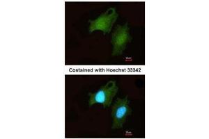 ICC/IF Image Immunofluorescence analysis of methanol-fixed HeLa, using DIP2B, antibody at 1:200 dilution. (DIP2B anticorps  (C-Term))
