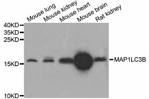 Western blot analysis of extracts of various cell lines, using MAP1LC3B antibody (ABIN4904290) at 1:1000 dilution. (LC3B anticorps)