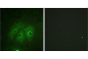 Immunofluorescence analysis of HeLa cells, using p47 phox (Phospho-Ser359) Antibody. (NCF1 anticorps  (pSer359))