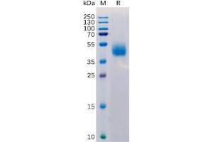 Human MICB Protein, His Tag on SDS-PAGE under reducing condition. (MICB Protein (His tag))