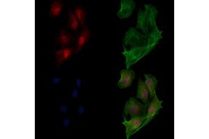 ABIN6265199 and ABIN6273321 staining  cells by IF/ICC. (SMYD3 anticorps  (N-Term))