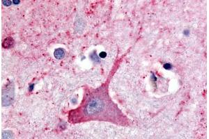 anti-Thyrotropin-Releasing Hormone Receptor (TRHR) (C-Term) antibody