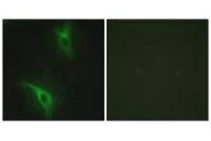 Immunofluorescence analysis of HeLa cells, using CKS1 antibody. (CKS1 anticorps  (N-Term))