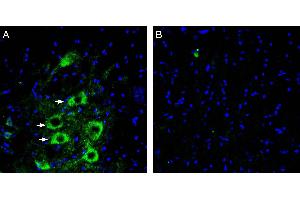 Expression of GPR97 in rat spinal cord. (GPR97 anticorps  (Extracellular))