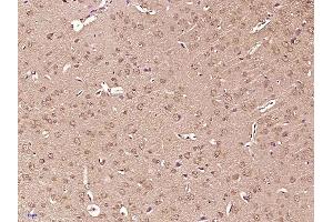 Paraformaldehyde-fixed, paraffin embedded mouse brain, Antigen retrieval by boiling in sodium citrate buffer (pH6) for 15min, Block endogenous peroxidase by 3% hydrogen peroxide for 30 minutes, Blocking buffer (normal goat serum) at 37°C for 20min, Antibody incubation with Tuberin (Thr927) Polyclonal Antibody  at 1:400 overnight at 4°C, followed by a conjugated secondary and DAB staining. (Tuberin anticorps  (pThr927))