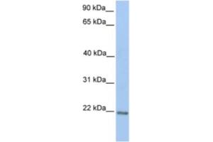 Western Blotting (WB) image for anti-Zinc Finger Protein 548 (ZNF548) antibody (ABIN2461998) (ZNF548 anticorps)