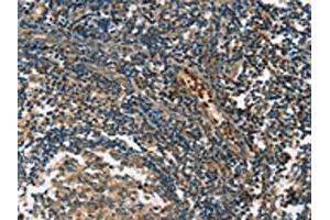 The image on the left is immunohistochemistry of paraffin-embedded Human tonsil tissue using ABIN7190849(GPR182 Antibody) at dilution 1/30, on the right is treated with synthetic peptide. (G Protein-Coupled Receptor 182 anticorps)