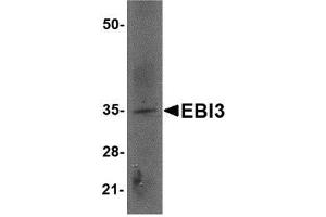 Western blot analysis of EBI3 in rat spleen tissue lysate with AP30307PU-N EBI3 antibody at 2 μg/ml.