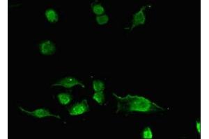 Immunofluorescent analysis of U251 cells using ABIN7143262 at dilution of 1:100 and Alexa Fluor 488-congugated AffiniPure Goat Anti-Rabbit IgG(H+L)