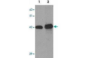 Western blot analysis of SLC39A12 in HepG2 cell lysate with SLC39A12 polyclonal antibody  at (1) 0. (SLC39A12 anticorps  (N-Term))