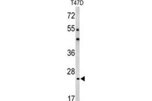 Western Blotting (WB) image for anti-BCL2-Related Protein A1 (BCL2A1) antibody (ABIN2997079)