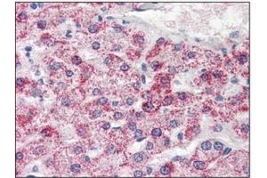 Immunohistochemistry (IHC) image for anti-Phosphoserine Phosphatase (PSPH) (AA 1-225), (N-Term) antibody (ABIN317526) (PSPH anticorps  (N-Term))