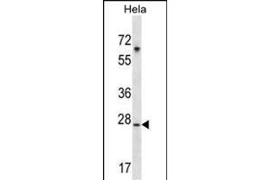 SRPK1 Antibody (M1) (ABIN391794 and ABIN2841649) western blot analysis in Hela cell line lysates (35 μg/lane). (SRPK1 anticorps  (N-Term))