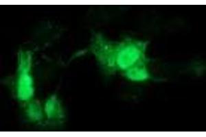 Anti-GCKR mouse monoclonal antibody (ABIN2454032) immunofluorescent staining of COS7 cells transiently transfected by pCMV6-ENTRY GCKR (RC214230). (GCKR anticorps)