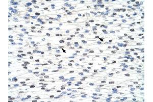 anti-Adenosine Deaminase, tRNA-Specific 1 (ADAT1) (C-Term) antibody