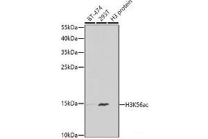 Western blot analysis of extracts of various cell lines using Acetyl-Histone H3-K56 Polyclonal Antibody at dilution of 1:1000. (Histone 3 anticorps  (acLys56))