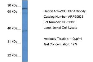 WB Suggested Anti-ZCCHC7  Antibody Titration: 0. (ZCCHC7 anticorps  (C-Term))